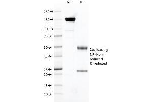 SDS-PAGE Analysis Purified FOLH1 Mouse Monoclonal Antibody (FOLH1/2121). (PSMA Antikörper  (AA 232-433))