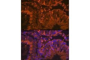 Immunofluorescence analysis of rat testis using SRD5 Rabbit mAb (ABIN7270595) at dilution of 1:100 (40x lens). (SRD5A2 Antikörper)
