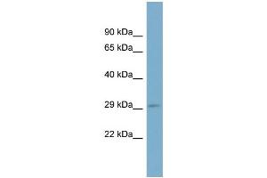 WB Suggested Anti-RAB23 Antibody Titration: 0. (RAB23 Antikörper  (N-Term))