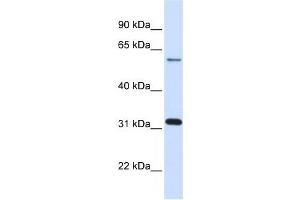 LGALS3 antibody used at 1 ug/ml to detect target protein. (Galectin 3 Antikörper  (N-Term))