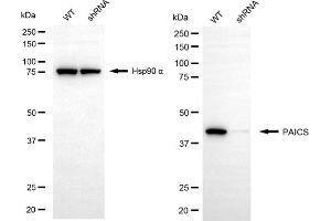 anti-phosphoribosylaminoimidazole Carboxylase, phosphoribosylaminoimidazole Succinocarboxamide Synthetase (PAICS) antibody