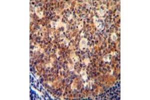 Immunohistochemistry analysis in human tonsil tissue (formalin-fixed, paraffin-embedded) using Interleukin-12 beta/IL12B Antibody (C-term), followed by peroxidase conjugation of the secondary antibody and DAB staining. (IL12B Antikörper  (C-Term))