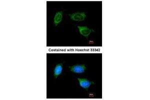 ICC/IF Image Immunofluorescence analysis of methanol-fixed HeLa, using ATP synthase B1, antibody at 1:200 dilution. (ATP Synthase B1 (Center) Antikörper)