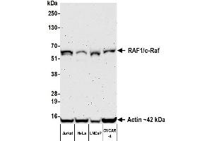 Western Blotting (WB) image for anti-V-Raf-1 Murine Leukemia Viral Oncogene Homolog 1 (RAF1) (AA 300-350) antibody (ABIN7795692)