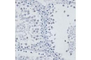 Immunohistochemistry of paraffin-embedded rat testis using MSH6 antibody (ABIN7268710) at dilution of 1:100 (40x lens). (MSH6 Antikörper  (AA 1-290))