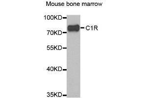 Western blot analysis of extracts of mouse bone marrow, using C1R antibody.