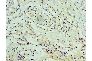 Immunohistochemistry of paraffin-embedded human epityphlon tissue using ABIN7169332 at dilution of 1:100