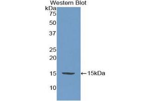Western blot analysis of the recombinant protein. (Adrenomedullin Antikörper  (AA 27-184))