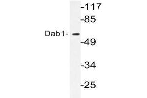Western blot (WB) analyzes of Dab1 antibody in extracts from HepG2 cells. (DAB1 Antikörper)