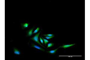 Immunofluorescence of purified MaxPab antibody to NR4A2 on HeLa cell.