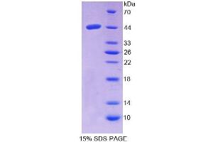 SDS-PAGE analysis of Human NPC2 Protein. (NPC2 Protein)