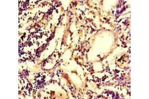 Immunohistochemistry of paraffin-embedded human appendix tissue using ABIN7147801 at dilution of 1:100 (IRG1 Antikörper  (AA 57-257))