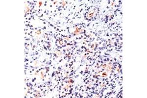 Immunohistochemistry (IHC) image for anti-Folate Hydrolase (Prostate-Specific Membrane Antigen) 1 (FOLH1) (C-Term) antibody (ABIN2470727) (PSMA Antikörper  (C-Term))