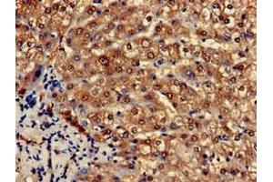 Immunohistochemistry of paraffin-embedded human liver tissue using ABIN7164812 at dilution of 1:100 (PCCA Antikörper  (AA 585-720))