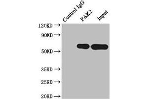 Immunoprecipitating PAK2 in Raji whole cell lysate Lane 1: Rabbit control IgG instead of ABIN7127664 in Raji whole cell lysate. (Rekombinanter PAK2 Antikörper)