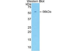 Western blot analysis of the recombinant protein. (KIR3DL2 Antikörper  (AA 184-435))