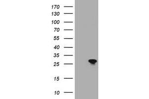 Image no. 1 for anti-B-Cell CLL/lymphoma 10 (BCL10) antibody (ABIN1496850) (BCL10 Antikörper)