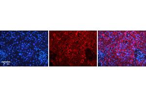 Immunohistochemistry (IHC) image for anti-N-Acylaminoacyl-Peptide Hydrolase (APEH) (N-Term) antibody (ABIN2783264)