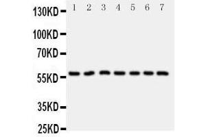 Anti-CYP11B1 antibody, Western blottingAll lanes: Anti CYP11B1  at 0.