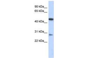 Image no. 1 for anti-Chromosome 13 Open Reading Frame 31 (C13orf31) (AA 179-228) antibody (ABIN6743720) (LACC1 Antikörper  (AA 179-228))