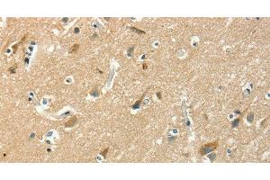Immunohistochemistry of paraffin-embedded Human brain using ASAH2 Polyclonal Antibody at dilution of 1:50