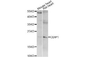 Western blot analysis of extracts of various cell lines, using CDIP1 antibody (ABIN6293220) at 1:1000 dilution. (CDIP1 Antikörper)
