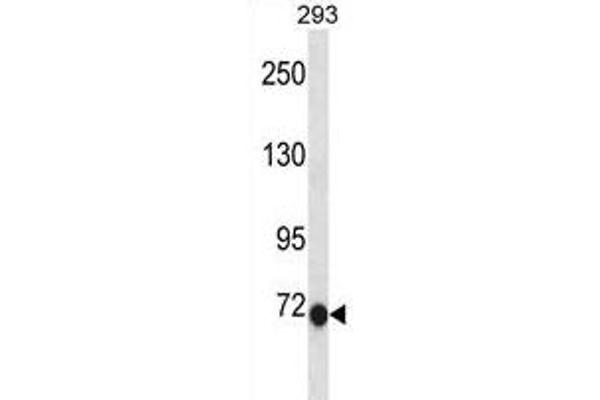 CLIC6 Antikörper  (C-Term)