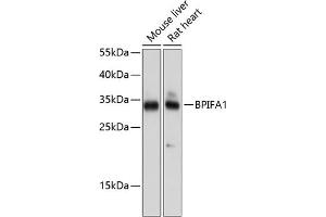 Western blot analysis of extracts of various cell lines, using BPIF antibody (ABIN6132500, ABIN6137634, ABIN6137635 and ABIN6224733) at 1:1000 dilution. (BPIFA1 Antikörper  (AA 20-256))