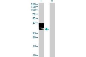 Western Blot analysis of GNPTG expression in transfected 293T cell line by GNPTG MaxPab polyclonal antibody. (GNPTG Antikörper  (AA 19-304))