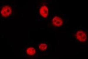 ABIN6275738 staining HepG2 by IF/ICC. (Arx Antikörper  (Internal Region))