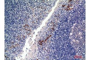 Immunohistochemistry (IHC) analysis of paraffin-embedded Human Tonsils, antibody was diluted at 1:100.