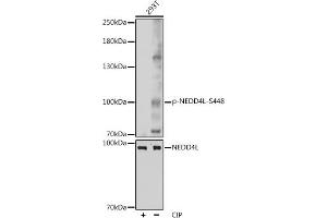 Western blot analysis of extracts of 293T cells, using Phospho-NEDD4L-S448 pAb (ABIN7266883) at 1:1000 dilution or NEDD4L antibody (ABIN6132407, ABIN6144504, ABIN6144505 and ABIN6224109). (NEDD4-2 Antikörper  (pSer448))