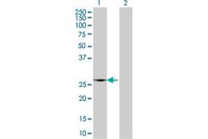 Western Blot analysis of F8 expression in transfected 293T cell line by F8 MaxPab polyclonal antibody. (Factor VIII Antikörper  (AA 1-216))