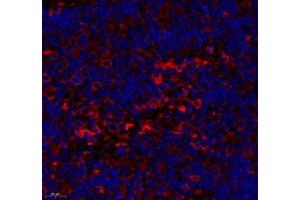 Immunofluorescence of paraffin embedded rat lymph node using CD163b (ABIN7073371) at dilution of 1: 700 (450x lens)