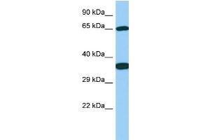 Host: Rabbit Target Name: Galnt13 Sample Type: Rat Stomach lysates Antibody Dilution: 1. (GALNT13 Antikörper  (C-Term))