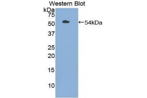 Western blot analysis of the recombinant protein. (TLR3 Antikörper  (AA 727-905))