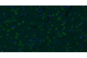 Paraformaldehyde-fixed, paraffin embedded rat brain, Antigen retrieval by boiling in sodium citrate buffer (pH6) for 15min, Block endogenous peroxidase by 3% hydrogen peroxide for 30 minutes, Blocking buffer (normal goat serum) at 37°C for 20min, Antibody incubation with Progestin Receptor Beta/MPRB Antibody  at 1:400 overnight at 4°C, followed by a conjugated secondary Goat Anti-Rabbit IgG antibody -FITC) for 90 minutes, and DAPI for nuclei staining. (Progestin Receptor beta/mprb (AA 251-300) Antikörper)