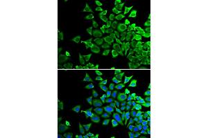 Immunofluorescence analysis of HeLa cells using BAD antibody (ABIN5970771). (BAD Antikörper)