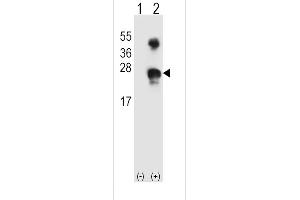 Western blot analysis of GADD45A (arrow) using rabbit polyclonal GADD45A Antibody (N-term) (ABIN389281 and ABIN2839407). (GADD45A Antikörper  (N-Term))