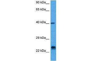 Host:  Mouse  Target Name:  ASCL1  Sample Tissue:  Mouse Pancreas  Antibody Dilution:  1ug/ml (ASCL1 Antikörper  (N-Term))