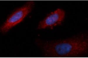 Immunofluorescence (IF) image for anti-Lactate Dehydrogenase B (LDHB) (AA 1-334) antibody (PE) (ABIN5565786) (LDHB Antikörper  (AA 1-334) (PE))