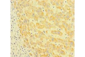Immunohistochemistry of paraffin-embedded human liver tissue using ABIN7164777 at dilution of 1:100 (LEPREL1 Antikörper  (AA 301-528))