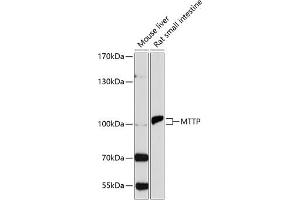 Western blot analysis of extracts of various cell lines, using MTTP antibody (ABIN3022483, ABIN3022484, ABIN3022485 and ABIN6218847) at 1:1000 dilution. (MTTP Antikörper  (AA 1-130))