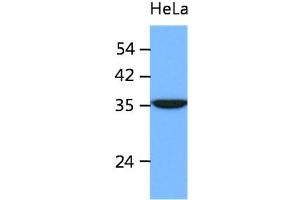 The cell lysates of HeLa (40ug) were resolved by SDS-PAGE, transferred to PVDF membrane and probed with anti-human ING2 antibody (1:1000). (ING2 Antikörper)