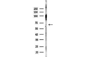 anti-Centromere Protein B (CENPB) (N-Term) antibody