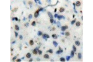 Used in DAB staining on fromalin fixed paraffin-embedded Stomach tissue (NFkB Antikörper  (AA 42-367))