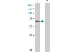 Western Blotting (WB) image for anti-Adaptor Protein, phosphotyrosine Interaction, PH Domain and Leucine Zipper Containing 1 (APPL1) (AA 1-709) antibody (ABIN525570)
