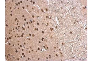 IHC-P Image MEF2C antibody detects MEF2C protein at nucleus on mouse fore brain by immunohistochemical analysis. (MEF2C Antikörper)