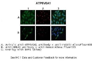 Immunohistochemistry (IHC) image for anti-ATPase, H+ Transporting, Lysosomal V0 Subunit A1 (ATP6V0A1) (C-Term) antibody (ABIN2780008)