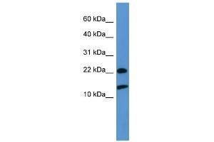 WB Suggested Anti-RPS27A Antibody Titration: 0. (RPS27A Antikörper  (Middle Region))